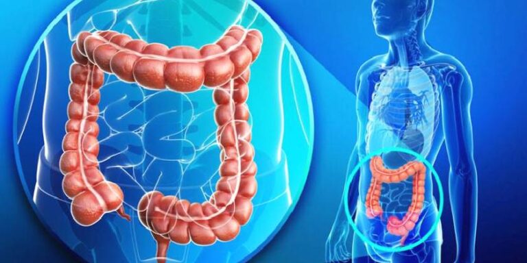 İnflamatuar bağırsak hastalığı: İngiliz araştırmacılar hastalığın başlıca nedenlerinden birini buldu