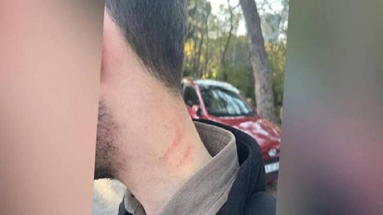 Medipol Üniversitesi’nde şiddet iddiası; dekan yardımcısı bir öğrenciyi darbetti