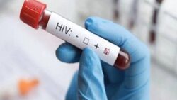 “HIV vakalarında artış var”: İşte 4 soruda en çok merak edilenler