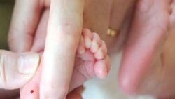 Uzmandan PKU hastalarına Kurban Bayramı için beslenme uyarısı