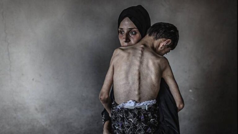 Gazze Şeridi’nde son 24 saatte 5 Filistinli daha açlıktan hayatını kaybetti