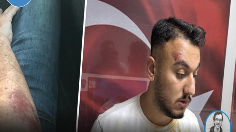 Pendik’te yoldan geçen kişilere “Huzur Denetimi” yapan polisten biber gazlı müdahale: Küfür ve darp iddiası!