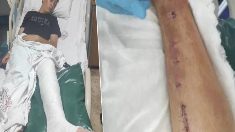 Akran zorbalığı sonucu 9. sınıf öğrencisinin ayağı kırıldı, okul aileyi “Çok kibar bir çocuk yetiştirmişsiniz” diye suçladı!