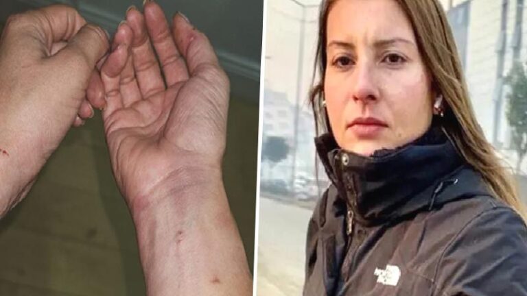 Gazeteci Neyran Elden: Polisler evde yere yatırarak gözüme yakın mesafeden biber gazı sıktılar, kelepçe taktılar