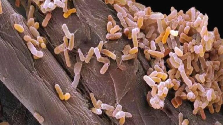 İstanbul’da iki çocuk ve annenin ölümünde gıda zehirlenmesi şüphesi: Hangi gıdalar daha riskli?