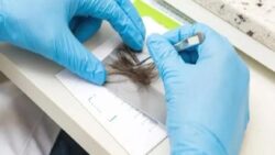 Adli Tıp uzmanları uyuşturucu testlerine dair merak edilenleri yanıtladı