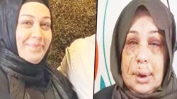 Evli olduğu kadına şiddet uygulayan Cumhurbaşkanı Koruma Dairesi personeli Çakmak’ın ifadesi: Arbedede tırnak makasıyla yaralandı