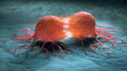 Uzmanlardan uyarı: Ailedeki kanser geçmişi, risk oluşturabilir; düzenli kontrole gidilmeli