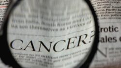 Dünya Sağlık Örgütü açıkladı: Her 10 kanser vakasından 4’ü önlenebilir