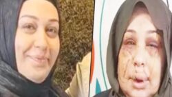 Boşanmak isteyen eşinin yüzünü kesen polis memuru Yasin Çakmak için 15 yıl hapis istemi