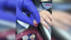 AVM’de yürüyen merdivene eli sıkışan çocuğun parmağı koptu