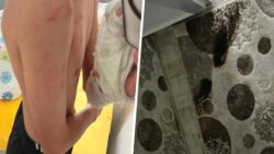 İddia: Polisler ‘yanlış adrese’ baskın yaptı; aile darbedildi, 15 yaşındaki çocuğun kolu kırıldı!