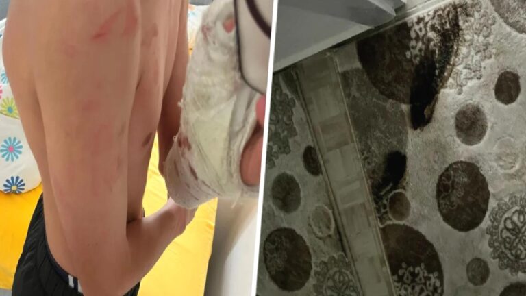İddia: Polisler ‘yanlış adrese’ baskın yaptı; aile darbedildi, 15 yaşındaki çocuğun kolu kırıldı!