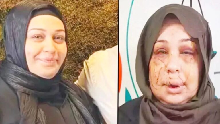 Boşanmak isteyen eşinin tırnak makasıyla yüzünü kesen Cumhurbaşkanı Koruma Dairesi personeline iyi hal indirimi; sadece 4 yıl 2 ay ceza aldı!